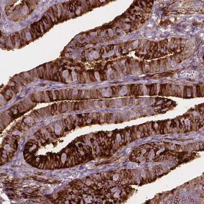 Immunohistochemistry-Paraffin: TM6SF2 Antibody [NBP2-49469] - Staining of human fallopian tube shows strong cytoplasmic positivity in glandular cells.