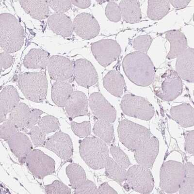 Immunohistochemistry-Paraffin: TM6SF2 Antibody [NBP2-49469] - Staining of human skeletal muscle shows no positivity in myocytes as expected.