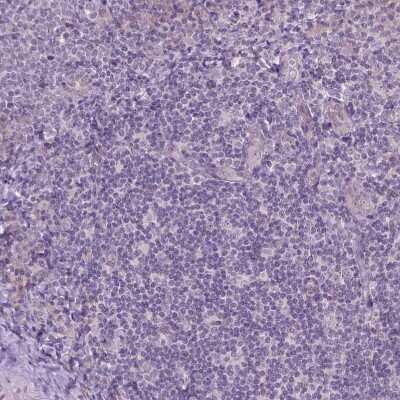 Immunohistochemistry-Paraffin: TM6SF2 Antibody [NBP2-49469] - Staining of human tonsil shows no positivity in non-germinal center cells as expected.