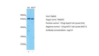 Western Blot: TM6SF2 Antibody [NBP2-85928] - Host: Rabbit. Target: TM6SF2. Positive control (+): HepG2 (HG). Negative control (-): MCF7 (N10). Antibody concentration: 1ug/ml