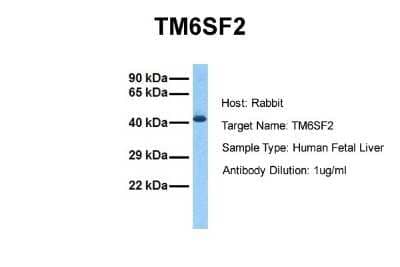 Western Blot: TM6SF2 Antibody [NBP2-85928] - Host: Rabbit. Target Name: TM6SF2. Sample Tissue: Human Fetal Liver. Antibody Dilution: 1.0ug/ml