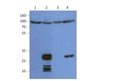 Western Blot: TM6SF2 Antibody [NBP3-12202] - Diluted at 1:500, used in lanes 3 and 4 as primary antibody. Catalog Number NBP3-12197 used in lanes 1 and 2 as primary antibodyLane 1 = empty vehicle, Lane 2 = recombinant mouse TM6SF2, Lane 3 = empty vehicle, Lane 4 = recombinant human TM6SF2