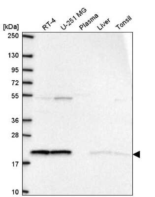 Western Blot: TM7SF2 Antibody [NBP2-57265] - Analysis in human cell line RT-4, human cell line U-251 MG, human plasma, human liver tissue and human tonsil tissue.