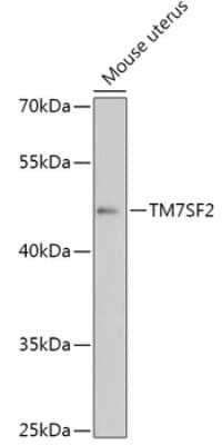 Western Blot TM7SF2 Antibody - Azide and BSA Free