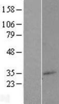 Western Blot: TM7SF2 Overexpression Lysate (Adult Normal) [NBP2-08024] Left-Empty vector transfected control cell lysate (HEK293 cell lysate); Right -Over-expression Lysate for TM7SF2.