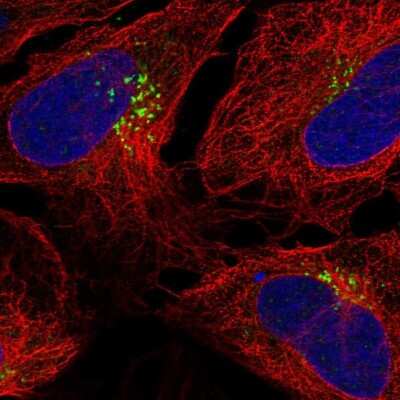 Immunocytochemistry/ Immunofluorescence TM9SF1 Antibody - BSA Free
