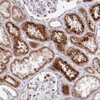 Immunohistochemistry-Paraffin TM9SF1 Antibody - BSA Free