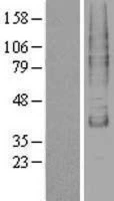 Western Blot TM9SF1 Overexpression Lysate