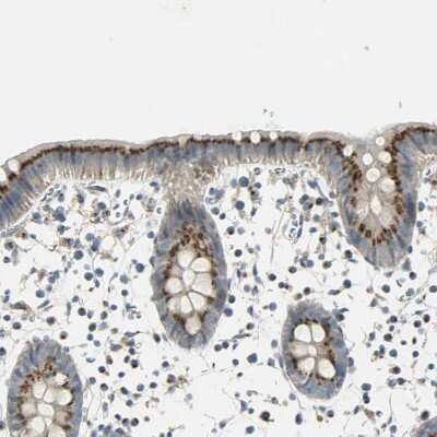 Immunohistochemistry-Paraffin: TM9SF2 Antibody [NBP1-80958] - Staining of human colon shows moderate to strong endosomal positivity in glandular cells.