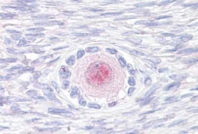 Immunohistochemistry-Paraffin TM9SF4 Antibody - BSA Free