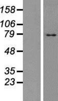 Western Blot: TM9SF4 Overexpression Lysate (Adult Normal) [NBP2-07280] Left-Empty vector transfected control cell lysate (HEK293 cell lysate); Right -Over-expression Lysate for TM9SF4.