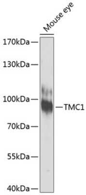 Western Blot: TMC1 Antibody [NBP3-05608] - Western blot analysis of extracts of mouse eye, using TMC1 antibody (NBP3-05608) at 1:1000 dilution. Secondary antibody: HRP Goat Anti-Rabbit IgG (H+L) at 1:10000 dilution. Lysates/proteins: 25ug per lane. Blocking buffer: 3% nonfat dry milk in TBST._Detection: ECL Enhanced Kit. Exposure time: 90s.