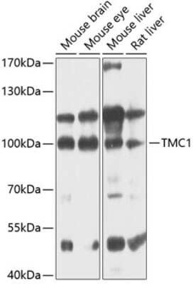 Western Blot TMC1 Antibody - BSA Free