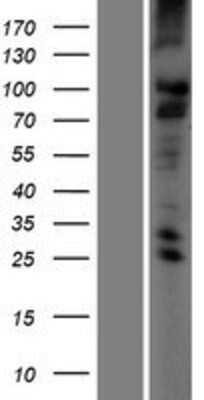 Western Blot: TMC2 Overexpression Lysate (Adult Normal) [NBP2-05763] Left-Empty vector transfected control cell lysate (HEK293 cell lysate); Right -Over-expression Lysate for TMC2.