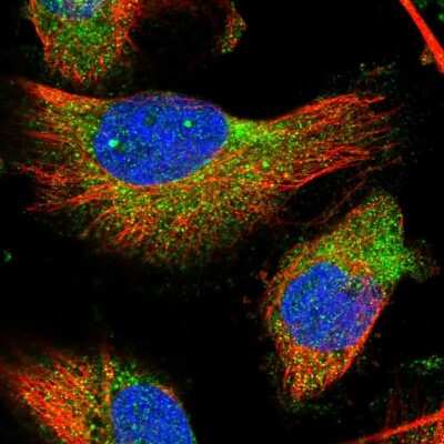 Immunocytochemistry/ Immunofluorescence TMC3 Antibody