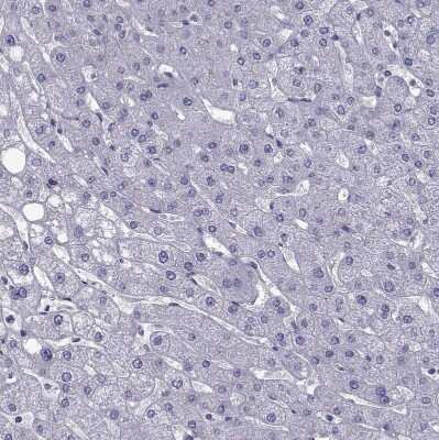 Immunohistochemistry-Paraffin: TMC3 Antibody [NBP1-86240] - Staining of human liver shows no positivity in hepatocytes as expected.