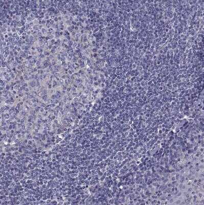 Immunohistochemistry-Paraffin: TMC3 Antibody [NBP1-86240] - Staining of human tonsil shows no positivity as expected.