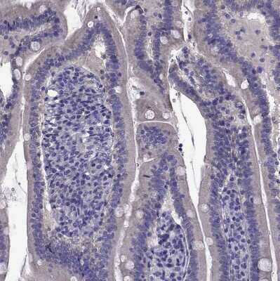 Immunohistochemistry-Paraffin: TMC3 Antibody [NBP1-86240] - Staining of human duodenum shows no positivity in glandular cells as expected.