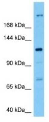 Western Blot TMC3 Antibody