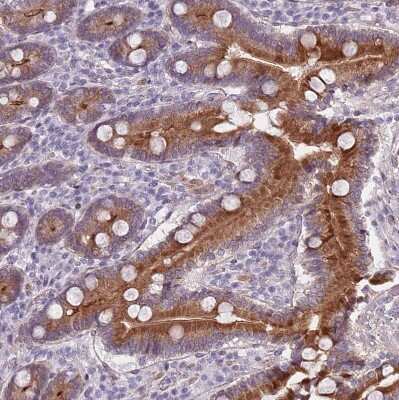 Immunohistochemistry-Paraffin TMC4 Antibody