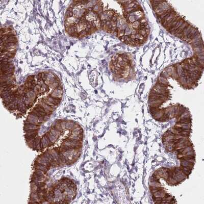 Immunohistochemistry-Paraffin TMC4 Antibody