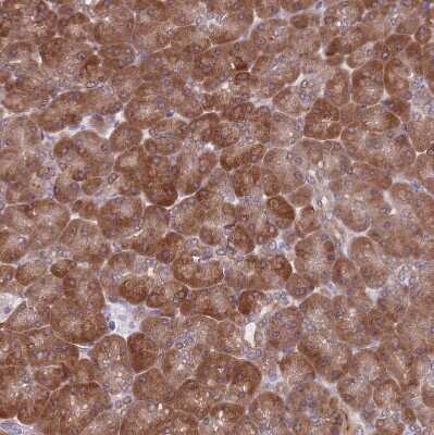 Immunohistochemistry-Paraffin: TMC4 Antibody [NBP2-13437] - Staining of human pancreas shows strong cytoplasmic positivity in exocrine glandular cells.