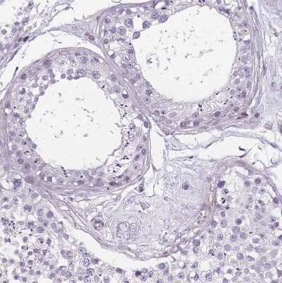 Immunohistochemistry-Paraffin TMC4 Antibody