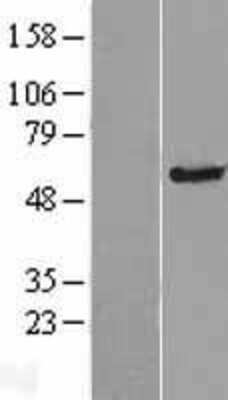 Western Blot TMC4 Overexpression Lysate