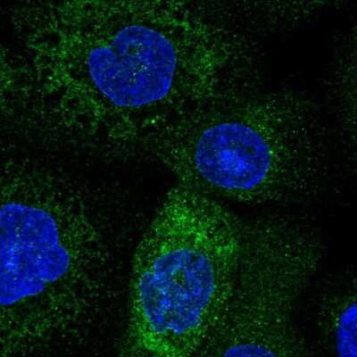 Immunocytochemistry/Immunofluorescence: TMCO1 Antibody [NBP2-55683] - Staining of human cell line A-431 shows localization to endoplasmic reticulum.