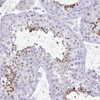 Immunohistochemistry-Paraffin TMCO5 Antibody - BSA Free