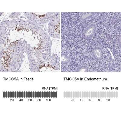 Immunohistochemistry-Paraffin TMCO5 Antibody - BSA Free