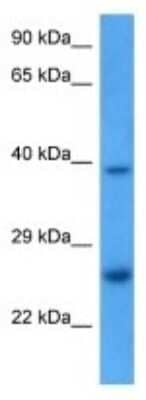 Western Blot: TMED1 Antibody [NBP3-09998] - Western blot analysis of TMED1 in Mouse Pancreas lysates. Antibody dilution at 1.0ug/ml