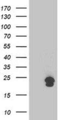 Western Blot: TMED1 Antibody (OTI7D2) - Azide and BSA Free [NBP2-74533] - HEK293T cells were transfected with the pCMV6-ENTRY control (Left lane) or pCMV6-ENTRY TMED1 (Right lane) cDNA for 48 hrs and lysed. Equivalent amounts of cell lysates (5 ug per lane) were separated by SDS-PAGE and immunoblotted with anti-TMED1.