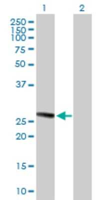 Western Blot: TMED1 Antibody [H00011018-B01P] - Analysis of TMED1 expression in transfected 293T cell line by TMED1 polyclonal antibody.  Lane 1: TMED1 transfected lysate(24.97 KDa). Lane 2: Non-transfected lysate.