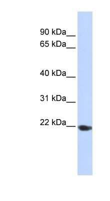 Western Blot: TMED1 Antibody [NBP1-62557] - 293T cells lysate, concentration 0.2-1 ug/ml.