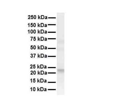 Western Blot: TMED1 Antibody [NBP1-62557] - Antibody  Titration: 1 ug/ml Human liver.