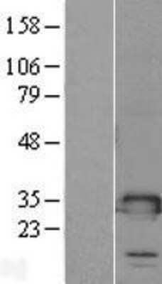 Western Blot: TMED1 Overexpression Lysate (Adult Normal) [NBL1-16979] Left-Empty vector transfected control cell lysate (HEK293 cell lysate); Right -Over-expression Lysate for TMED1.
