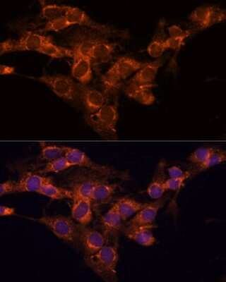 Immunocytochemistry/Immunofluorescence: TMED2 Antibody [NBP2-94067] - Analysis of C6 cells using TMED2 at dilution of 1:100. Blue: DAPI for nuclear staining.