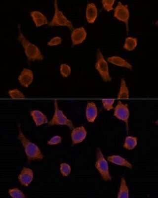 Immunocytochemistry/Immunofluorescence: TMED2 Antibody [NBP2-94067] - Analysis of L929 cells using TMED2 at dilution of 1:100. Blue: DAPI for nuclear staining.