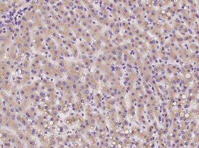 Immunohistochemistry-Paraffin: TMED2 Antibody [NBP3-06498] - Staining of human TMED2 in human liver with rabbit polyclonal antibody at 1:100 dilution.