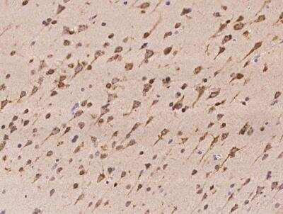 Immunohistochemistry-Paraffin: TMED2 Antibody [NBP3-06498] - Staining of human TMED2 in human brain with rabbit polyclonal antibody at 1:100 dilution.