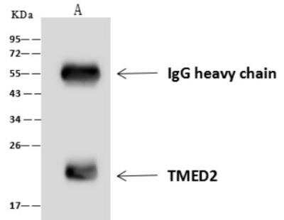 Immunoprecipitation: TMED2 Antibody [NBP3-06498] - Lane A:0.5 mg RAJI Whole Cell Lysate4 uL anti-TMED2 rabbit polyclonal antibody and 60 ug of Immunomagnetic beads Protein A/G.Primary antibody:Anti-TMED2 rabbit polyclonal antibody,at 1:100 dilution Secondary antibody:Goat Anti-Rabbit IgG (H+L)/HRP at 1/10000 dilutionDeveloped using the ECL technique.Performed under reducing conditions.Predicted band size: 23 kDaObserved band size :23 kDa