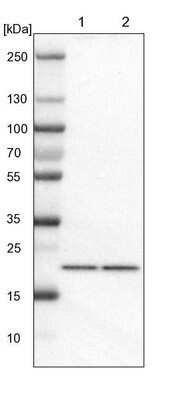 Western Blot: TMED2 Antibody [NBP1-80963] - Lane 1: NIH-3T3 cell lysate (Mouse embryonic fibroblast cells). Lane 2: NBT-II cell lysate (Rat Wistar bladder tumor cells).