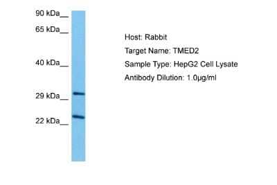 Western Blot: TMED2 Antibody [NBP2-83663] - Host: Rabbit. Target Name: TMED2. Sample Tissue: Human HepG2 Whole Cell lysates. Antibody Dilution: 1ug/ml