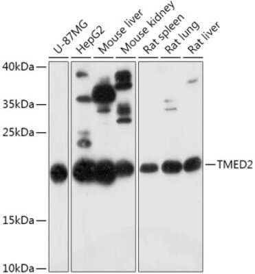 Western Blot: TMED2 Antibody [NBP2-94067] - Analysis of extracts of various cell lines, using TMED2 at 1:1000 dilution. Secondary antibody: HRP Goat Anti-Rabbit IgG (H+L) at 1:10000 dilution. Lysates/proteins: 25ug per lane. Blocking buffer: 3% nonfat dry milk in TBST. Detection: ECL Basic Kit . Exposure time: 3min.