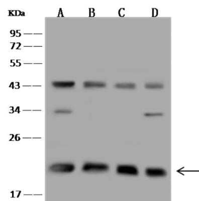 Western Blot: TMED2 Antibody [NBP3-06498] - Lane A: HeLa Whole Cell LysateLane B: Jurkat Whole Cell LysateLane C: Raji Whole Cell LysateLane D: NIH/3T3 Whole Cell LysateLysates/proteins at 30 ug per lane.SecondaryGoat Anti-Rabbit IgG (H+L)/HRP at 1/10000 dilution.Developed using the ECL technique.Performed under reducing conditions.Predicted band size:23 kDaObserved band size:23 kDa(We are unsure as to the identity of these extra bands.)