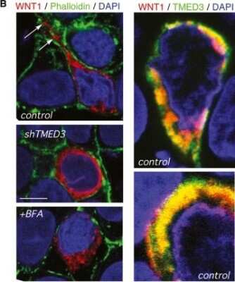 Immunocytochemistry/Immunofluorescence: TMED3 Antibody [NBP2-13439] - TMED3 is required for normal WNT localization. Confocal pictures showing the indicated immunofluorescent labeling in CC14 cells infected with control shTMED3 lentivectors, or treated with Brefeldin A (BFA). Images  are single confocal planes. Yellow color indicates a co-localization of red (WNT1) with green (TMED3, TGN46 or CALRETICULIN) signals. White arrows indicate WNT1-containing vesicular bodies. Cell contours are highlighted with a white line in (top left). Scale bar = 5 um (top left 3 panels), 2 um (top right 2 panels). Image collected and cropped by CiteAb from the following publication (//embomolmed.embopress.org/cgi/doi/10.15252/emmm.201303799), licensed under a CC-BY license.