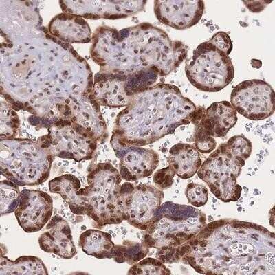 Immunohistochemistry-Paraffin: TMED3 Antibody [NBP2-13439] - Staining of human placenta shows strong nuclear and cytoplasmic positivity in trophoblastic cells.