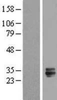 Western Blot: TMED6 Overexpression Lysate (Adult Normal) [NBL1-16984] Left-Empty vector transfected control cell lysate (HEK293 cell lysate); Right -Over-expression Lysate for TMED6.