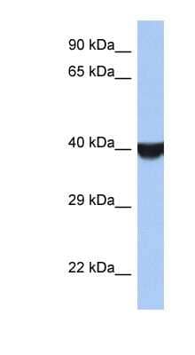 Western Blot: TMED8 Antibody [NBP1-55452] - Jurkat cell lysate, concentration 0.2-1 ug/ml.